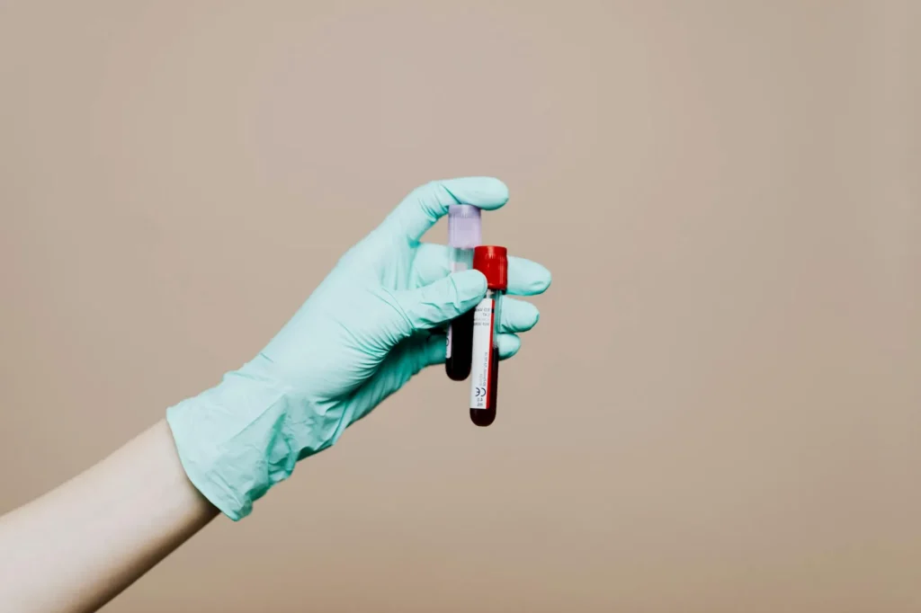 Diagnosis How Is Anemia in Pregnancy Detected