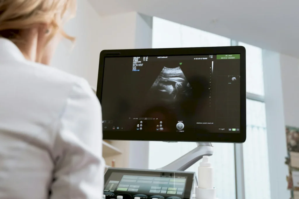 tilted uterus during pregnancy